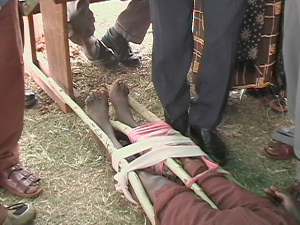 SEVO rescue drama, using local materials for splints.